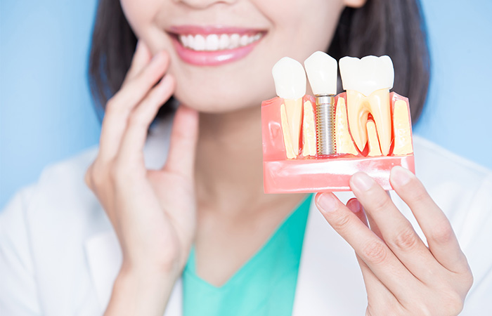 インプラント治療にも対応