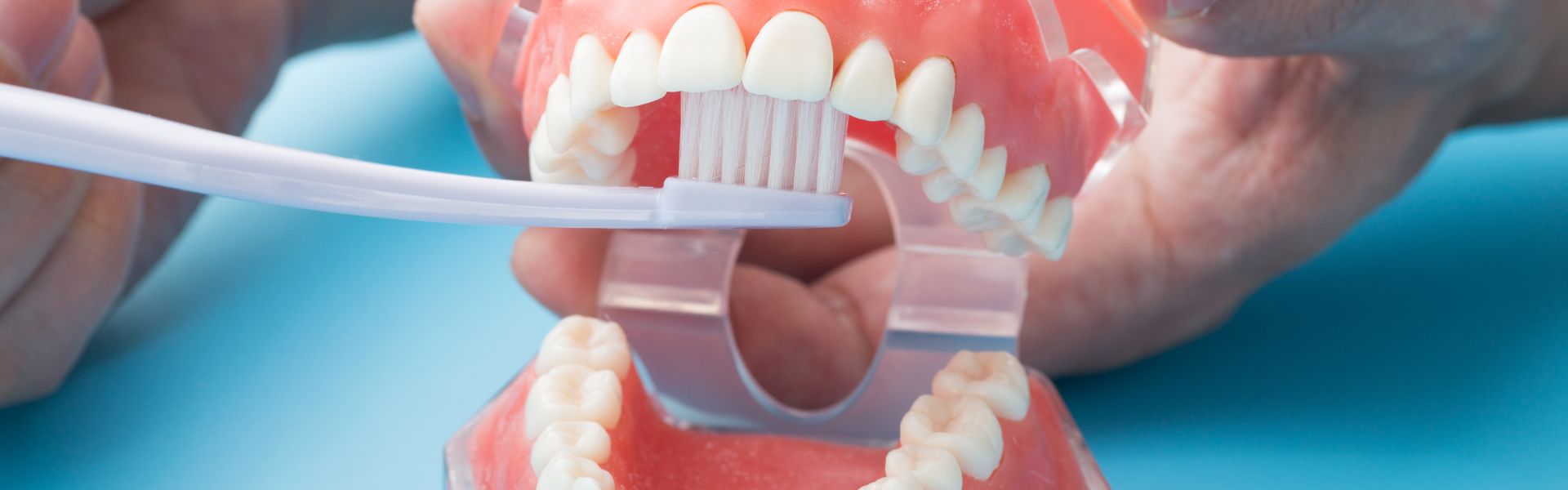 予防・クリーニング