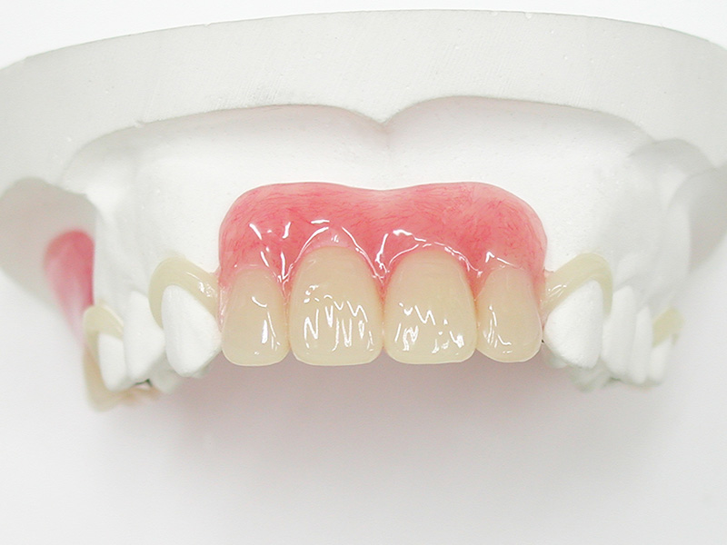 歯が黄ばむ理由